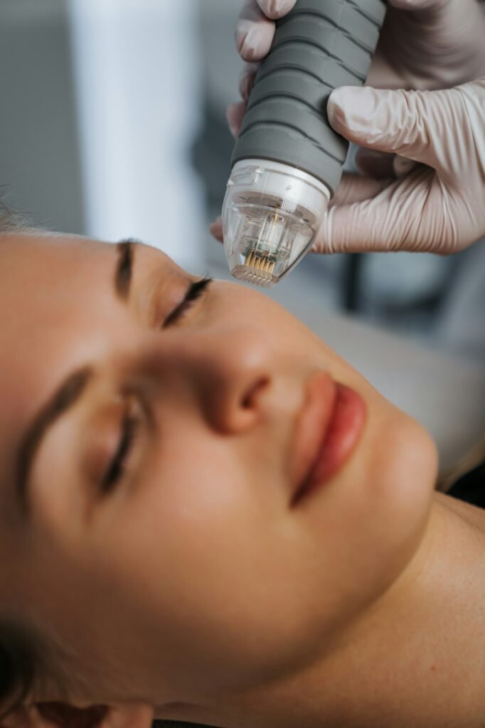 Microneedling Oslo (Frogner)