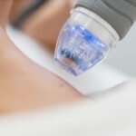 Hva er microneedling?